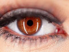 World Sight Day 2023: What Are Scotomas? Know What Causes These Blind Spots, And How They Can Be Treated