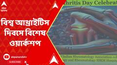 SSKM Hospital: বিশ্ব আথ্রাইটিস দিবসে এসএসকেমে আয়োজন করা হল বিশেষ ওয়ার্কশপের | ABP Ananda LIVE
