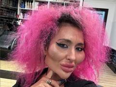 दुनिया में सबसे बड़े गाल वाली महिला, सर्जरी में उड़ाए लाखों रुपये, अब लोगों से जमकर मिल रही नफरत