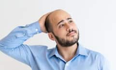 Male Baldness: শুধুই বয়স নয়, টাক পড়ার নেপথ্যে রয়েছে একাধিক কারণ