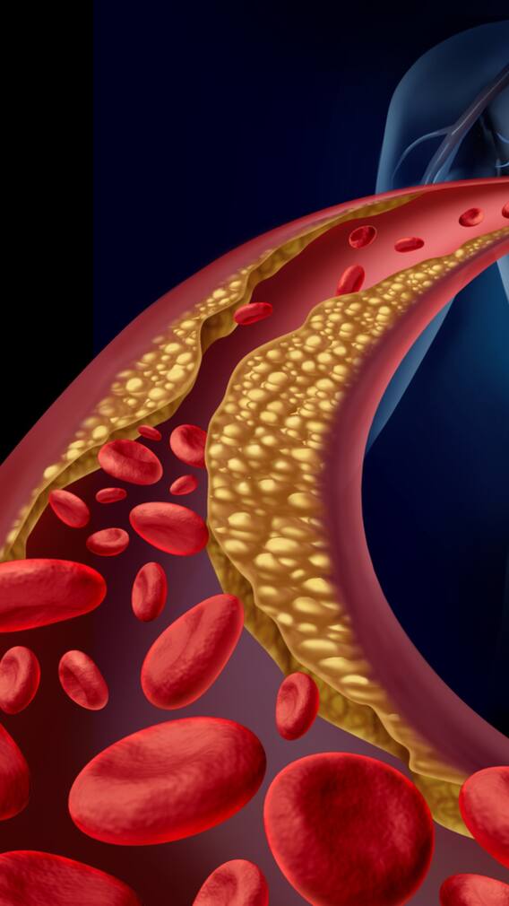 ਸਰਦੀਆਂ ‘ਚ ਵੱਧ ਗਿਆ ਕੋਲੈਸਟ੍ਰੋਲ ਤਾਂ ਇਦਾਂ ਕਰੋ ਘੱਟ, ਅਪਣਾਓ ਆਹ ਤਰੀਕੇ