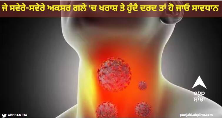 the 4 signs your sore throat could be deadly serious Health News : ਜੇ ਸਵੇਰੇ-ਸਵੇਰੇ ਅਕਸਰ ਗਲੇ 'ਚ ਖਰਾਸ਼ ਤੇ ਹੁੰਦੈ ਦਰਦ ਤਾਂ ਹੋ ਜਾਓ ਸਾਵਧਾਨ, ਇਹ 4 ਲੱਛਣ ਨਜ਼ਰ ਆਉਣ ਤਾਂ ਸਥਿਤੀ ਹੈ ਖ਼ਤਰਨਾਕ