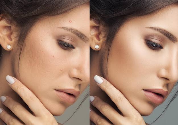 स्किन पर फेस पैक लगाते समय ध्यान दें: किसी भी फेस माक्स का इस्तेमाल हफ्ते में सिर्फ एक बार वो भी रात में करें.फेस मास्क को ठंडे पानी से ही धोएं.इसे चेहरे पर लगाने के बाद मॉइस्चराइजर की मोटी लेयर भी लगाएं.अगली सुबह चेहरे पर सनस्क्रीन लगाना न भूलें.