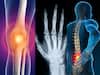 How To Differentiate Between Osteoarthritis, Rheumatoid Arthritis, And Spine Injuries? Know What Diseases Arthritis Leads To