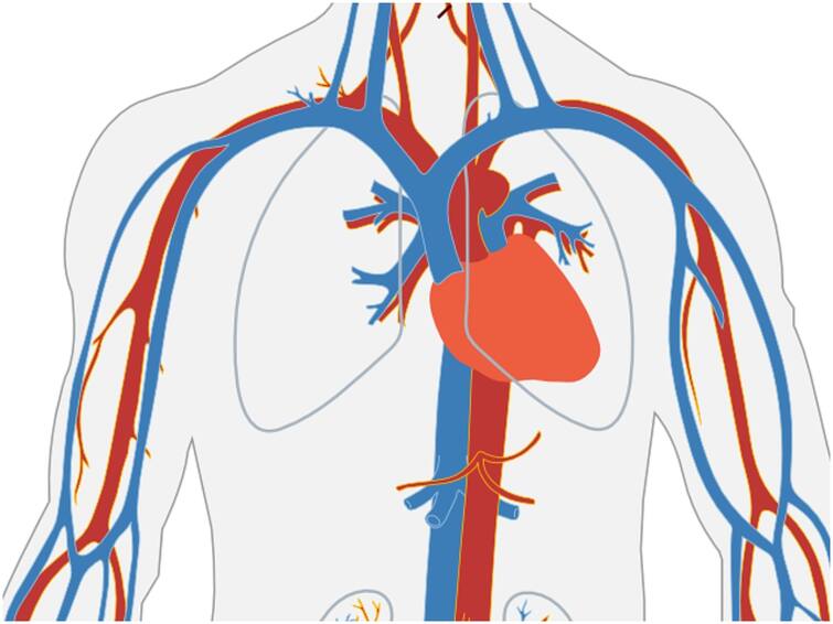 Are cardiac stents at risk of embolization? What do you do if you get buried? గుండెలో వేసిన స్టంట్‌లు పూడుకుపోయే ముప్పు ఉందా? పూడుకుపోతే ఏం చేస్తారు?