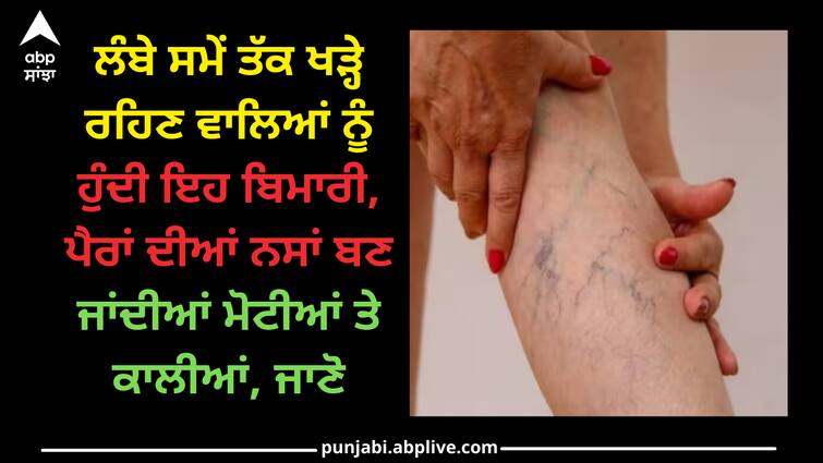 health-tips-varicose-veins-causes-symptoms-treatment Varicose Veins: ਲੰਬੇ ਸਮੇਂ ਤੱਕ ਖੜ੍ਹੇ ਰਹਿਣ ਵਾਲਿਆਂ ਨੂੰ ਹੁੰਦੀ ਇਹ ਬਿਮਾਰੀ, ਪੈਰਾਂ ਦੀਆਂ ਨਸਾਂ ਬਣ ਜਾਂਦੀਆਂ ਮੋਟੀਆਂ ਤੇ ਕਾਲੀਆਂ, ਜਾਣੋ