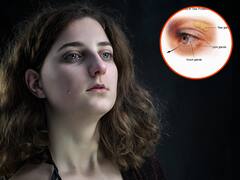 क्या आंख के इस छेद में से निकलते हैं आंसू? क्या आपने अपनी आंख में देखा है ये?