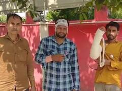 फतेहपुर में ग्राम प्रधान की दबंगई, ग्रामीणों पर कुल्हाड़ी और लाठियों से किया हमला