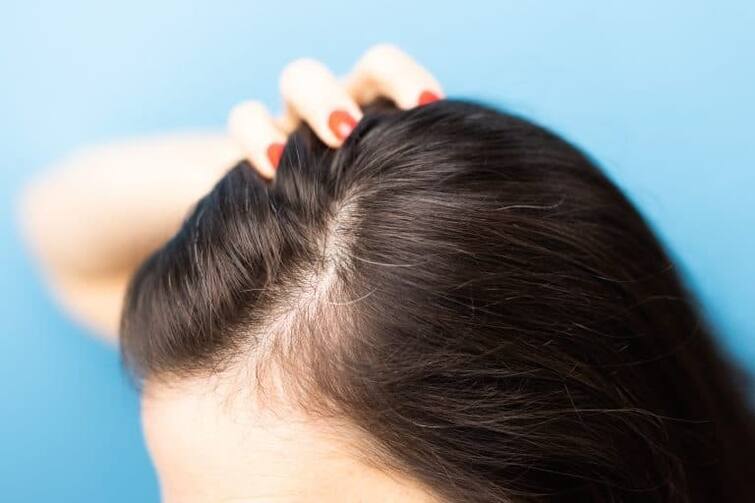 Hair Care Tips know these natural home remedies to get rid of dandruff during winters marathi news Hair Care Tips : हिवाळ्यात कोंड्याची चिंता वाटतेय? 'या' घरगुती उपायांनी कोंड्यापासून मिळवा सुटका