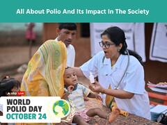World Polio Day 2023: All About Polio And Its Impact In The Society