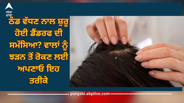 Dandruff problem caused by cold weather? Follow these methods to prevent hair loss Dandruff: ਠੰਡ ਵੱਧਣ ਨਾਲ ਸ਼ੁਰੂ ਹੋਈ ਡੈਂਡਰਫ ਦੀ ਸਮੱਸਿਆ? ਵਾਲਾਂ ਨੂੰ ਝੜਨ ਤੋਂ ਰੋਕਣ ਲਈ ਅਪਣਾਓ ਇਹ ਤਰੀਕੇ