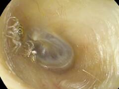 महिला को चार दिन से आ रही थी अजीबोगरीब आवाज, कान की जांच कराई तो सामने आया ये खौफनाक सच