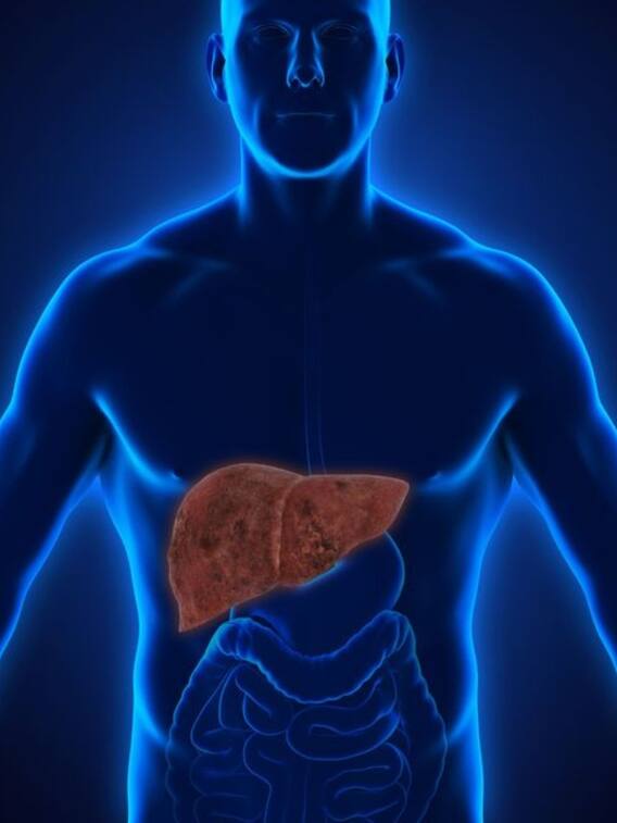 फैटी लिवर की समस्या से छुटकारा पाने के लिए करें ये उपाय