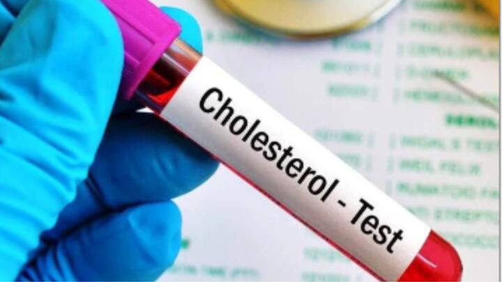 Cholesterol Control: বিশেষজ্ঞরা জানাচ্ছেন, প্রয়োজনে ওষুধ তো বটেই, কোলেস্টেরল নিয়ন্ত্রণে কয়েকটি খাবারের উপরও ভরসা রাখা যেতে পারে।