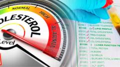 Health News:কোলেস্টেরল নিয়ন্ত্রণে থাকছে তো? না হলে খেয়ে দেখতে পারেন এই ৫ খাবার