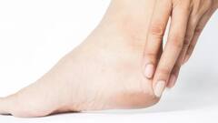 तुमच्याही टाचांना भेगा पडतायत? वाढलेल्या भेगांना सॉफ्ट करण्यासाठी 'या' सोप्या पद्धती फॉलो करा