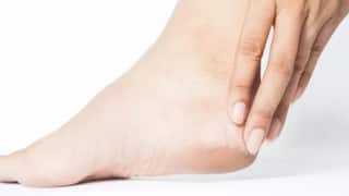 Health Tips : तुमच्याही टाचांना भेगा पडतायत? वाढलेल्या भेगांना सॉफ्ट करण्यासाठी 'या' सोप्या पद्धती फॉलो करा