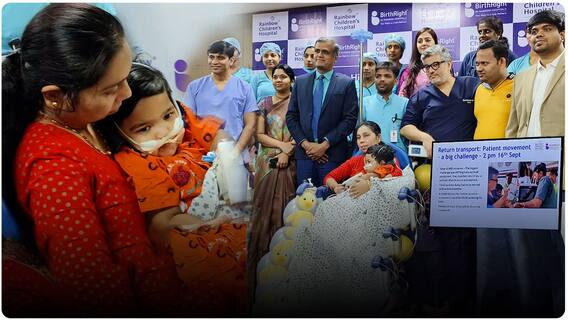 Rainbow Doctors save 18 month old Goa child:18 నెలల గోవా చిన్నారికి ఎక్మో అందించి కాపాడిన డాక్టర్లు