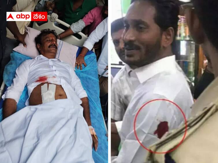 Telangana Elections 2023 :  What is the sign of knife attacks on leaders before elections? Telangana Elections 2023 : ఎన్నికలకు ముందు ముఖ్య నేతలపై కత్తి దాడులు - తెలుగు రాజకీయాలు హింసాత్మకదారిలోకి వెళ్తున్నాయా ?