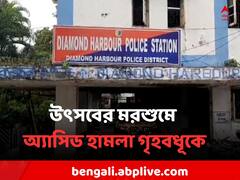 সন্দেহের জের, স্বামীর হাতেই অ্যাসিড হামলার শিকার বাংলার গৃহবধূ