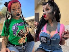 In Photos: खूबसूरत लड़की पर चढ़ा बिल्ली बनने का शौक, चेहरे पर करा ली ढेरों सर्जरी, तस्वीरें देख चकरा जाएगा दिमाग