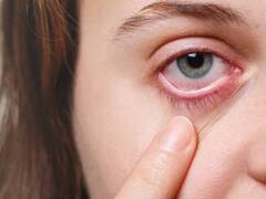 Diwali 2023: पटाखे जलाते वक्त अगर आंख में लग जाए चोट तो करें ये काम