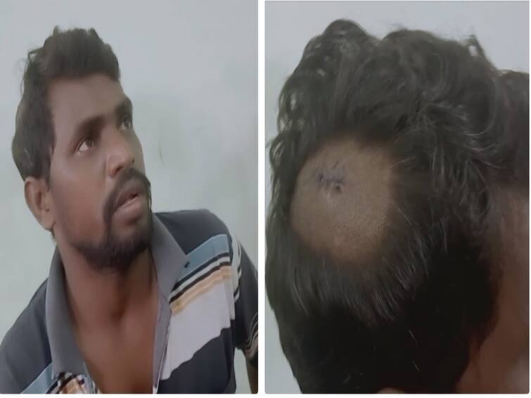Another caste attack in Nellai The affected youth was admitted to the hospital TNN நெல்லையில் மீண்டும் ஒரு சாதிய தாக்குதல்; பாதிக்கப்பட்ட இளைஞர் மருத்துவமனையில் அனுமதி