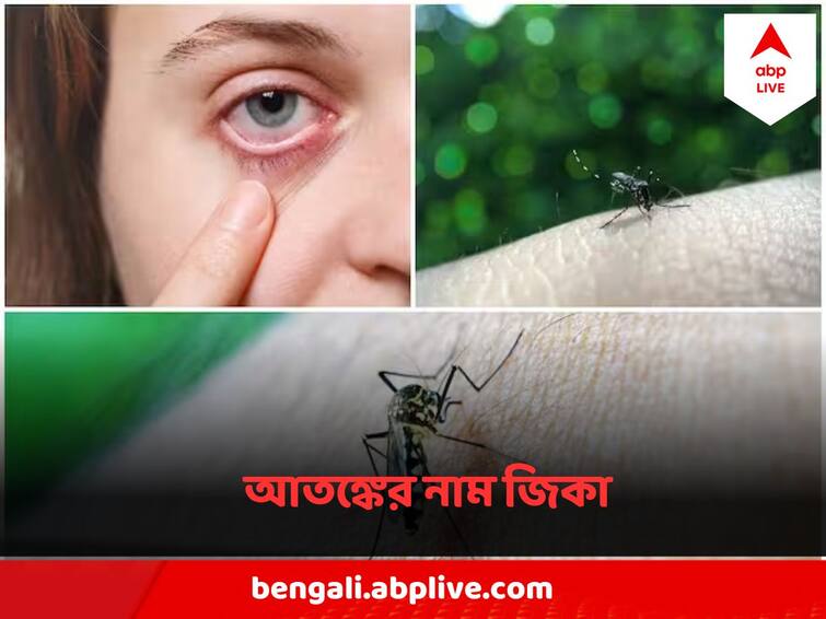 Zika Virus Panic In Karnataka, high alert after virus found in mosquito sample, Know the symptoms Zika Virus: উদ্বেগ বাড়াচ্ছে মশাবাহিত জিকা ভাইরাস! কড়া সতর্কতা জারি কর্ণাটকে, কী কী উপসর্গ