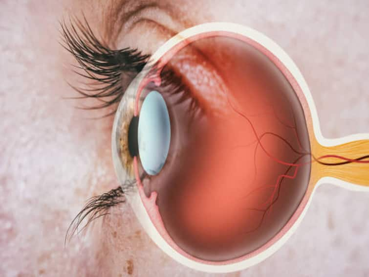 What is Diabetic Retinopathy These are the methods of control Diabetic Retinopathy: డయాబెటిక్ రెటినోపతి వస్తే చూపు పోతుందా, ఎలా కంట్రోల్ చెయ్యాలి