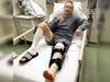 'MMA Fight Delayed': Meta CEO Mark Zuckerberg Undergoes Knee Surgery After Suffering Ligament Tear