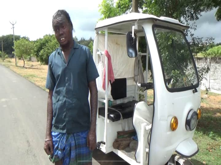 cleaner said that he spent Rs 3000 in drug stores to buy medicine for his illness and sought help from the MLA to make arrangements to get the medicine in the government hospital வினோத நோயால் அவதிப்படும் தூய்மை பணியாளர் - திருப்போரூர் எம்எல்ஏவிடம் வைத்த கோரிக்கை