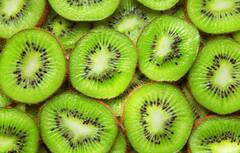 Health Tips: હજારો રૂપિયાનો દવાનો બચી જશે ખર્ચ, રોજ બે Kiwi ડાયટમાં કરો સામેલ