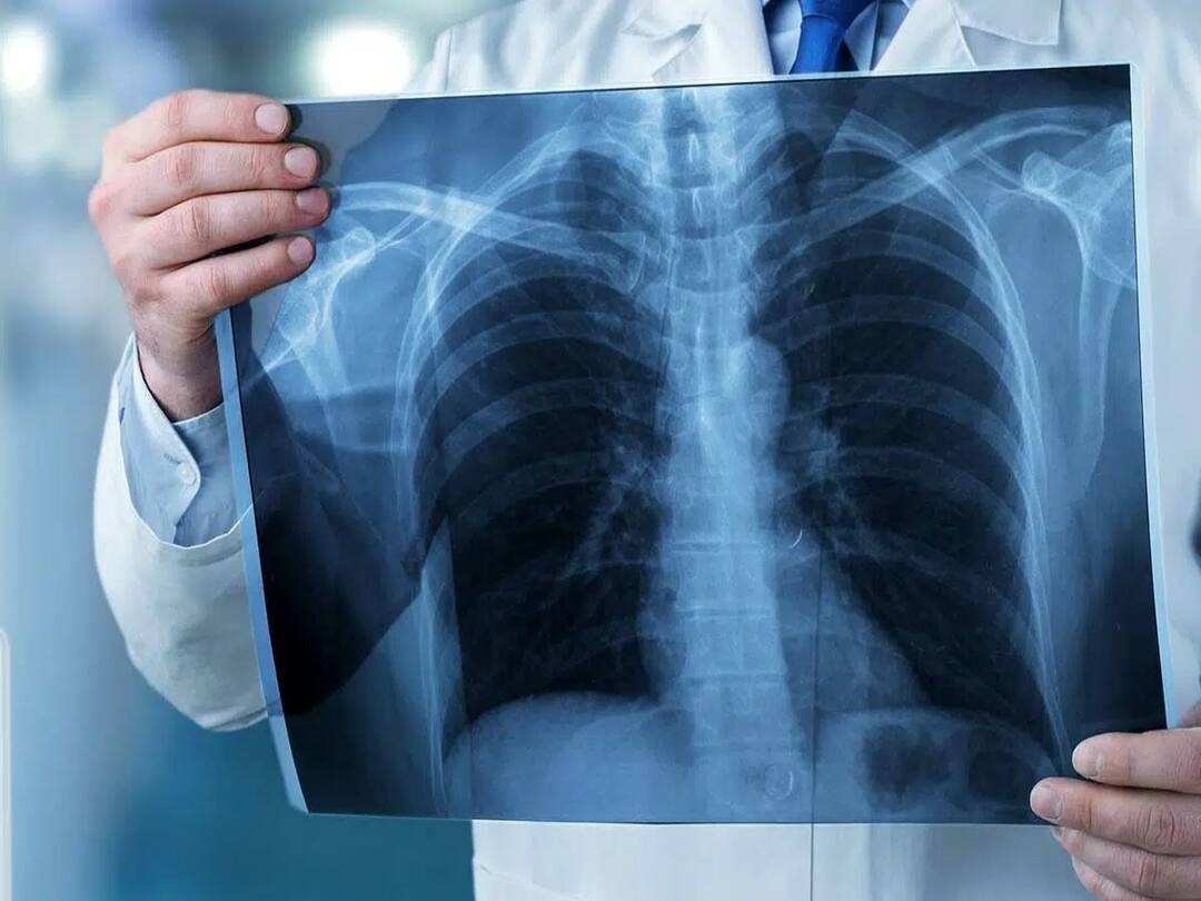 World Radiography Day 2023: இன்று உலக கதிரியக்க நாள்: எதற்கு கெண்டாடப்படுகிறது? முக்கியத்துவம் என்ன?