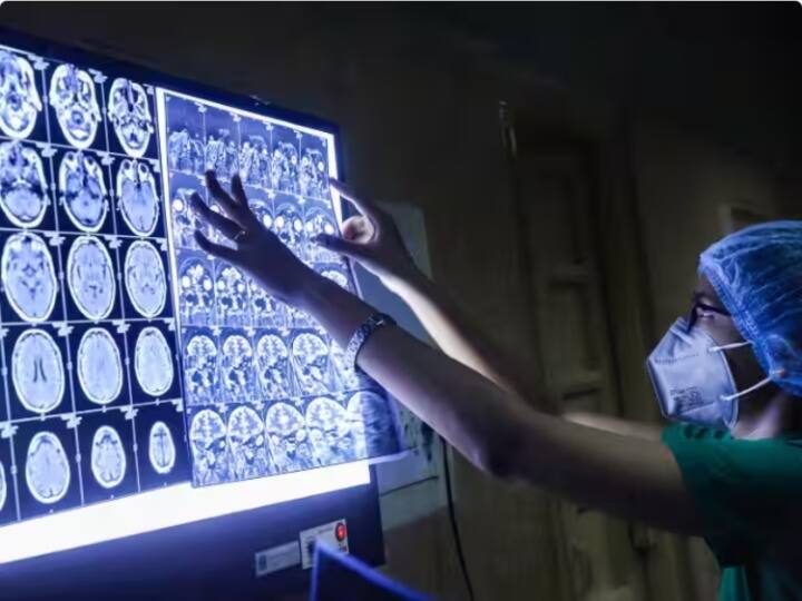 Black Fungus: पंजाब में लगातार बढ़ रहे है ब्लैक फंगस के मरीज, डॉक्टरों ने जताई चिंता, सरकार से की ये अपील Doctors expressed concern over increase in black fungus patients in Punjab, appealed to the government Black Fungus: पंजाब में लगातार बढ़ रहे है ब्लैक फंगस के मरीज, डॉक्टरों ने जताई चिंता, सरकार से की ये अपील