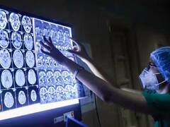 Black Fungus: ਪੰਜਾਬ ਵਿੱਚ ਲਗਾਤਾਰ ਵੱਧ ਰਹੇ ਹਨ ਬਲੈਕ ਫੰਗਸ ਦੇ ਮਰੀਜ਼, ਡਾਕਟਰਾਂ ਨੇ ਪ੍ਰਗਟਾਈ ਚਿੰਤਾ, ਸਰਕਾਰ ਨੂੰ ਕੀਤੀ ਅਪੀਲ