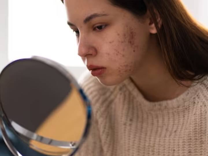 एयर पॉल्यूशन के कारण हो सकती है स्किन की ये खतरनाक बीमारी, खुजली और लाल दाने से होती है इसकी शुरुआत Delhi air pollution Poor Air quality affects skin problem says health expert एयर पॉल्यूशन के कारण हो सकती है स्किन की ये खतरनाक बीमारी, खुजली और लाल दाने से होती है इसकी शुरुआत