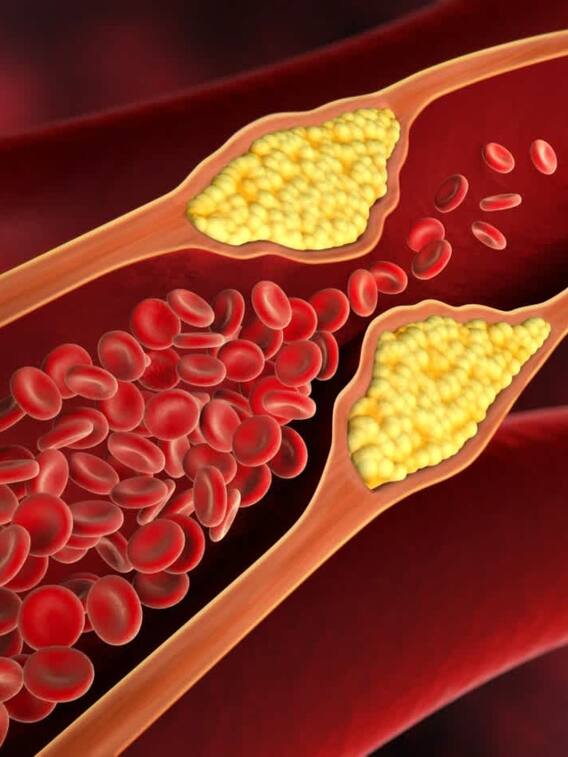 रोजाना पिएं ये ड्रिंक्स, बॉडी से कम होगा कोलेस्ट्रॉल
