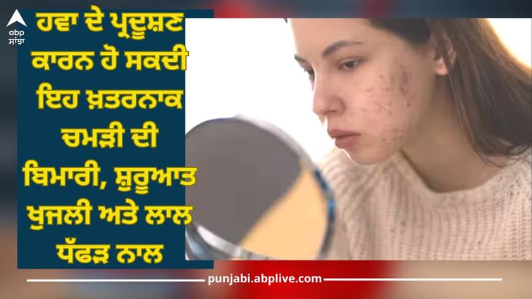 delhi air pollution poor air quality affects skin problem says health expert health news Air Pollution: ਹਵਾ ਦੇ ਪ੍ਰਦੂਸ਼ਣ ਕਾਰਨ ਹੋ ਸਕਦੀ ਇਹ ਖ਼ਤਰਨਾਕ ਚਮੜੀ ਦੀ ਬਿਮਾਰੀ, ਸ਼ੁਰੂਆਤ ਖੁਜਲੀ ਅਤੇ ਲਾਲ ਧੱਫੜ ਨਾਲ