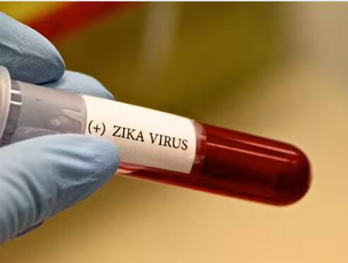 zika virus makes entry into pune health department initiates immediate preventive measures Pune ZIka Virus : पुणेकरांनो काळजी घ्या! शहरात झिका व्हायरसचा शिरकाव; वयस्कर महिलेला झिकाची लागण; 'या' लक्षणांकडे अजिबात दुर्लक्ष करु नका!