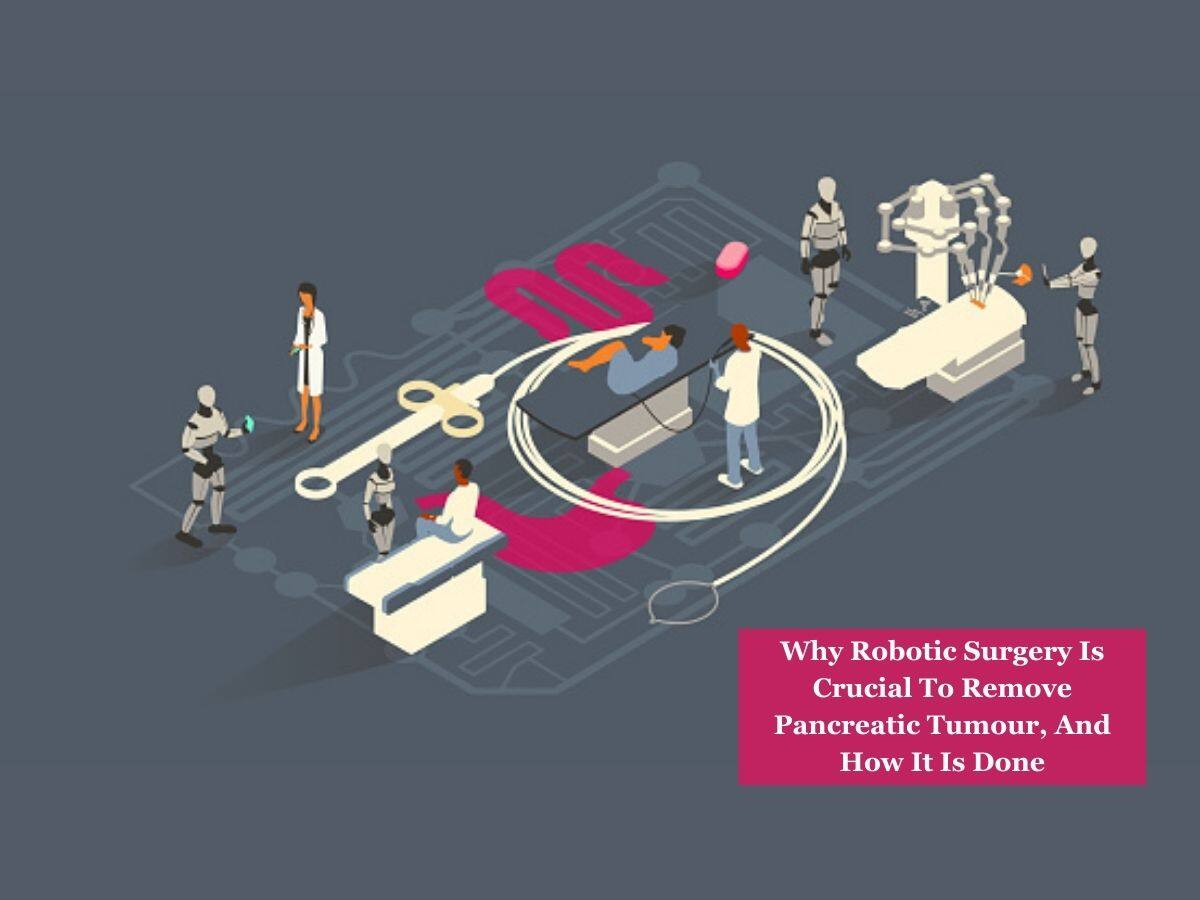 Pancreatic Cancer Day: Why Robotic Surgery Is Crucial To Remove Pancreatic Tumour, And How It Is Done