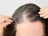 Premature Greying Hair: இளநரை பயமா? இந்த உணவுகளையெல்லாம் சாப்பிடால் இளநரையை தடுக்கலாம்!