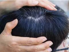 PHOTO: 'या' पदार्थांचा आहारात समावेश केल्याने मुलांचे केस पांढरे होण्यापासून वाचू शकतात!