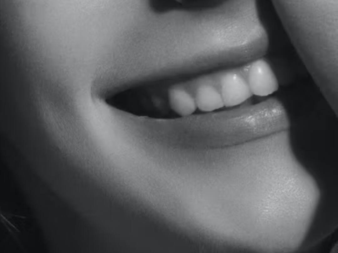 Food Healthy Teeth: ஆரோக்கியமான பற்கள் வேண்டுமா? இந்த உணவு முறையை கடைபிடியுங்கள்....