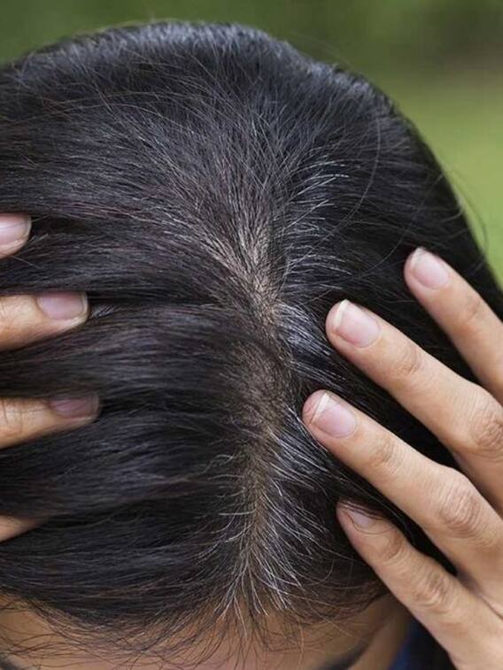 इस विटामिन की कमी से सिर के बाल हो जाएंगे सफेद