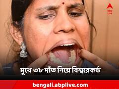 ৩২ নয়, মুখের ভিতরে ৩৮টি দাঁত! গিনেস ওয়ার্ল্ড রেকর্ড গড়লেন এই ভারতীয় মহিলা