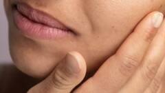 Lifestyle:শীত মানে খসখসে ত্বক? বাড়িতে এই ক'টি জিনিস থাকলেই আর চিন্তা নয়