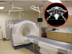 जब इतिहास में पहली बार एक जानवर ने कराया सीटी स्कैन, जानिए रिपोर्ट में क्या आया था