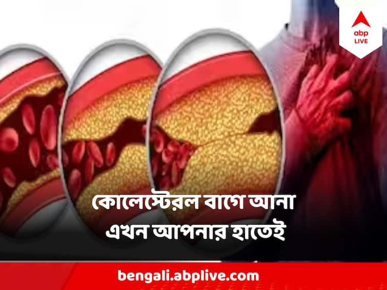 how to reduce cholesterol in 30 days Tips To Lower Cholesterol, Know Cholesterol Symptoms Tips To Lower Cholesterol: চুপিসাড়ে বাড়া কোলেস্টেরল বিকল করতে পারে হার্ট, চিনুন লক্ষণ, কমান এই ১০ উপায়ে