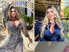 In Photos: मॉडल ने 2.50 करोड़ रुपये लगाकर करवाई प्लास्टिक सर्जरी लेकिन हो गया 'खेल', अब रिन्यू नहीं हो रहा ड्राइविंग लाइसेंस