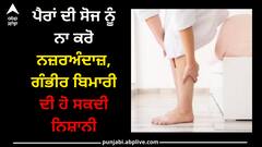 Feet: ਪੈਰਾਂ ਦੀ ਸੋਜ ਨੂੰ ਨਾ ਕਰੋ ਨਜ਼ਰਅੰਦਾਜ਼, ਗੰਭੀਰ ਬਿਮਾਰੀ ਦੀ ਹੋ ਸਕਦੀ ਨਿਸ਼ਾਨੀ